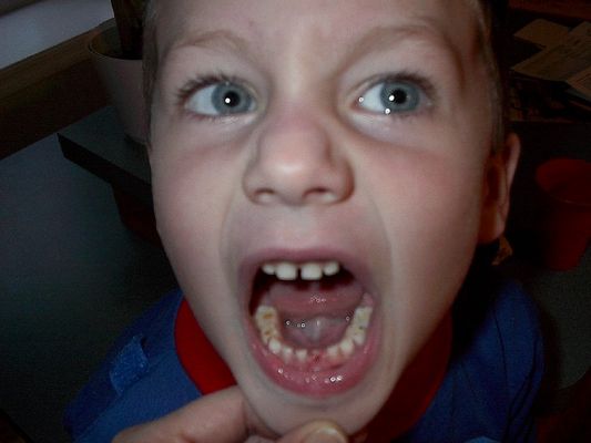 1st Tooth out  Jan 29 2003
